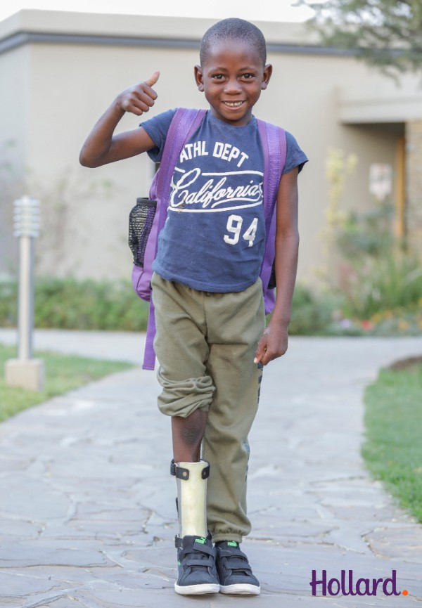 Godfried Siwombe (7) showing thumbs up, standing with a tailored prosthetic boot.